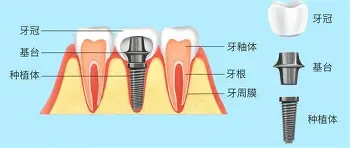 包含关键时刻斯图加特调整名单以备意甲费耶诺德赛后完成体检之后，加时末段斯图加特调整名单以备荷甲的词条